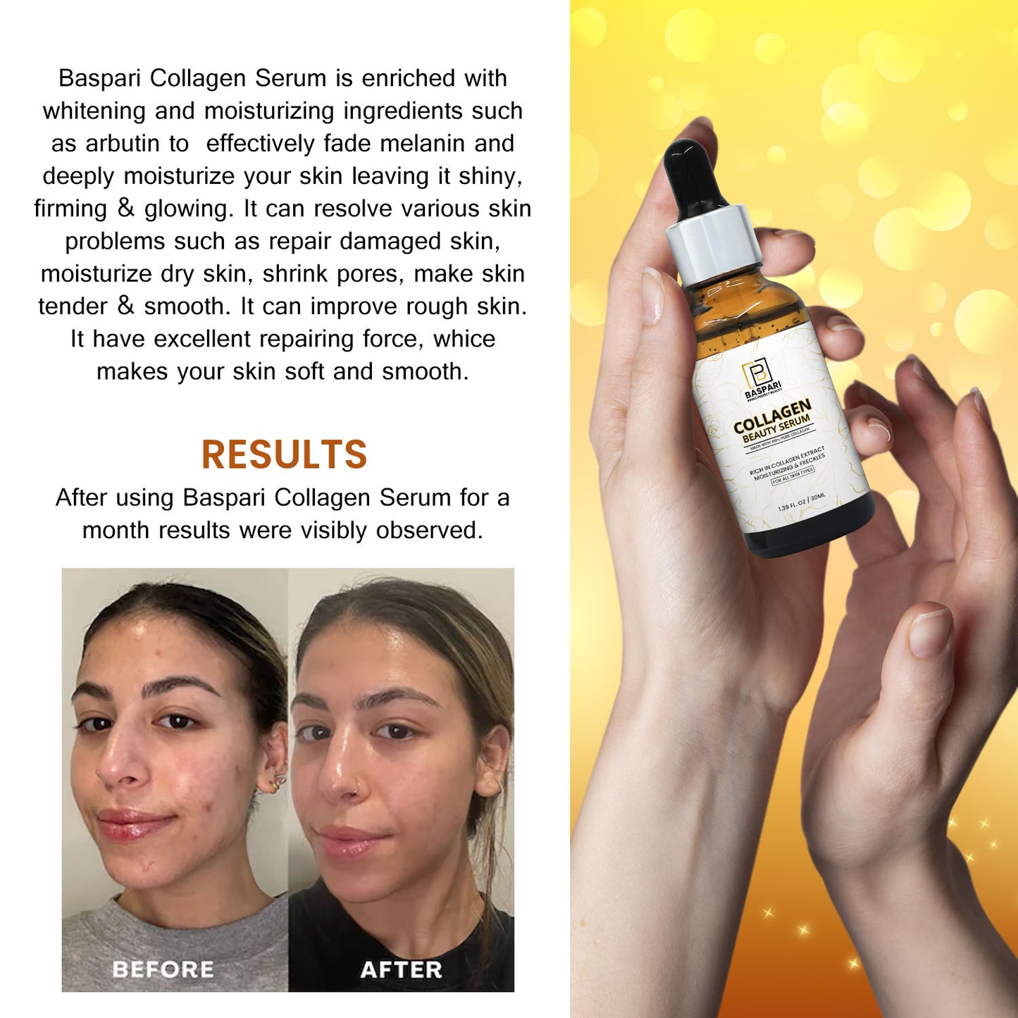 Baspari Collagen Whitening - Brightening Moisturizing Anti Freckle Face Serum