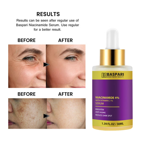 Baspari Niacinamide Acid Serum 4% with Vitamin C Serum 1% -   for Glowing Skin | Helps Reduce Dullness & Sun Damage | For Dry & Sensitive Skin | 30ml