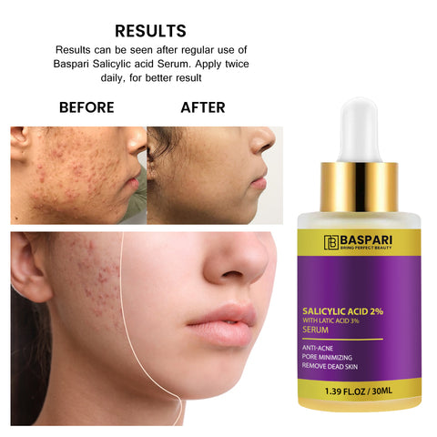 Baspari Salicylic Acid 2% with Latic Acid 3% Serum | Acne Treatment Serum, Helps Reduce Pimples in 3 Days | 30ml