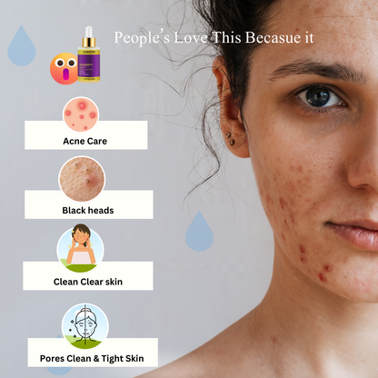 Baspari Salicylic Acid 2% with Latic Acid 3% Serum | Acne Treatment Serum, Helps Reduce Pimples in 3 Days | 30ml